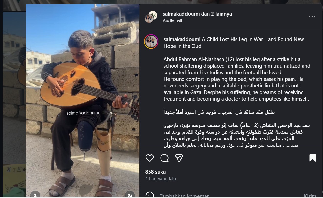 Kisah Abdul Rahman, Anak Gaza yang Menunggu Perawatan dan Kaki Palsu