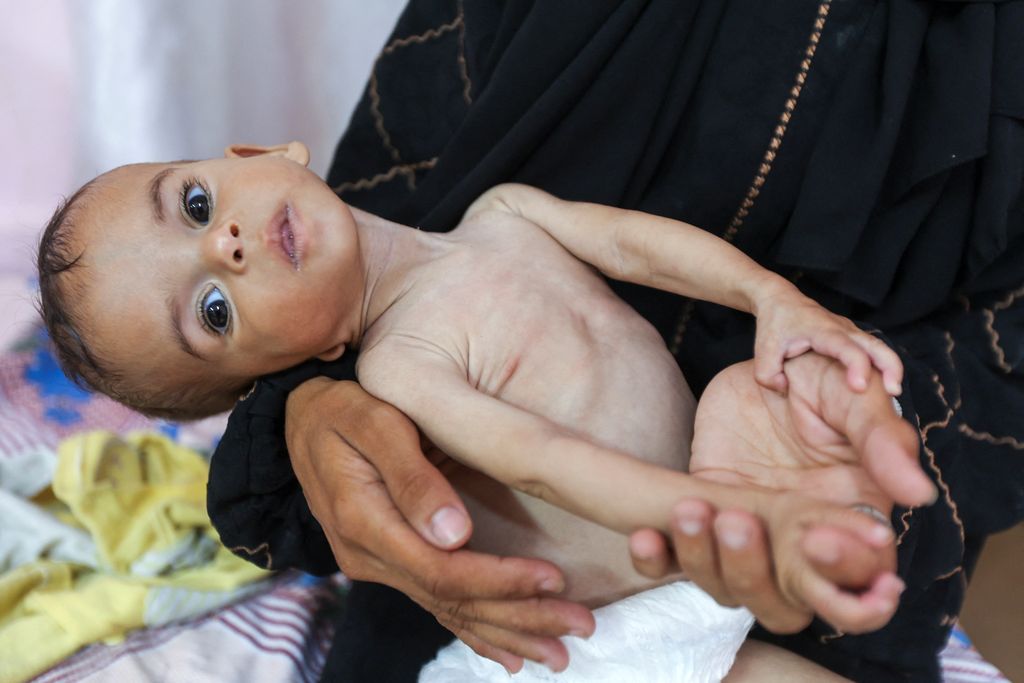98 Persen Lahan Pertanian Gaza Hancur, Gaza di Ambang Kelaparan Total
